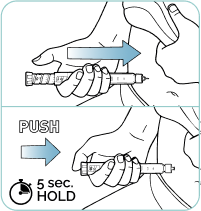 Needle inserted into the skin and held till 5 counts.