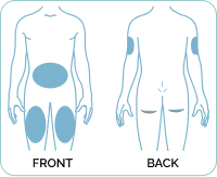 Ideal injection sites for Mounjaro.